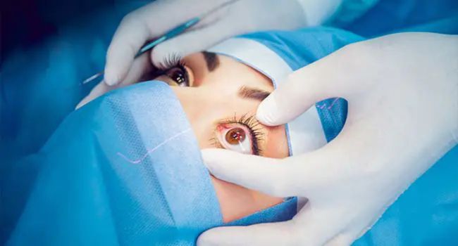 C3-R-For-Keratoconus