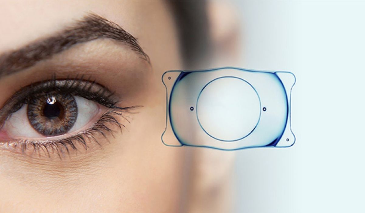 Ideal-Candidates-for-ICL