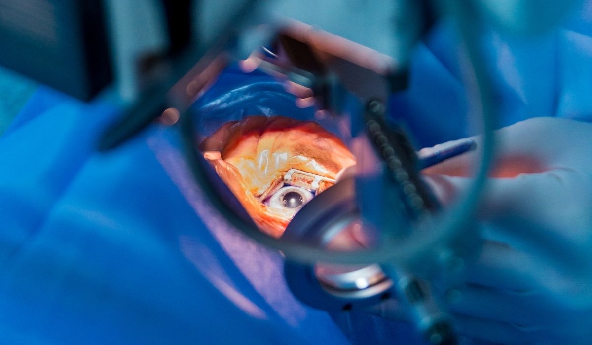 PHACO-Cataract-Surgery